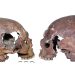 Cel mai vechi exemplu de craniu modificat artificial, din Europa, descoperit într-o peșteră din Italia